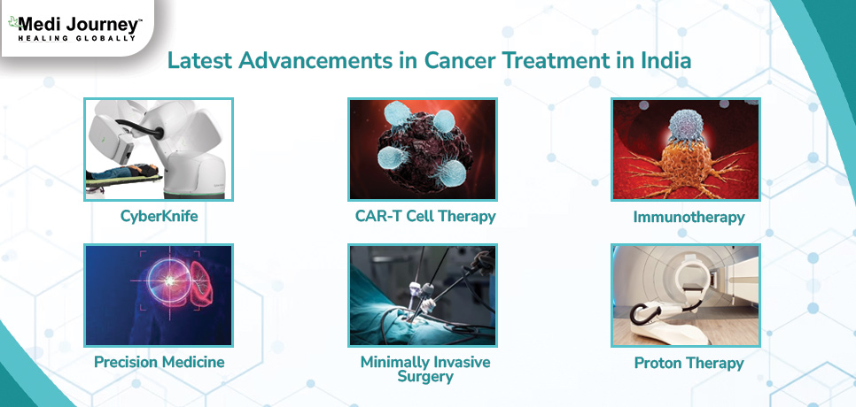 Latest Cancer Treatment in India