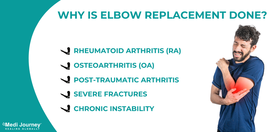 Need for Elbow Replacement 