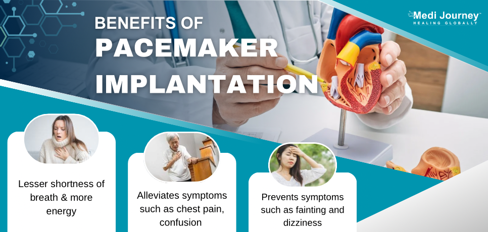 Benefits of Pacemaker Implantation