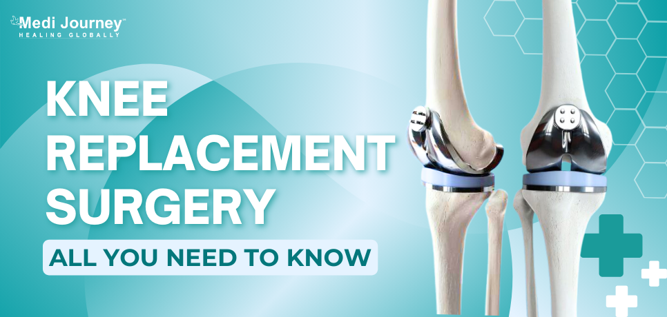 Knee Replacement Surgery: All You Need To Know About