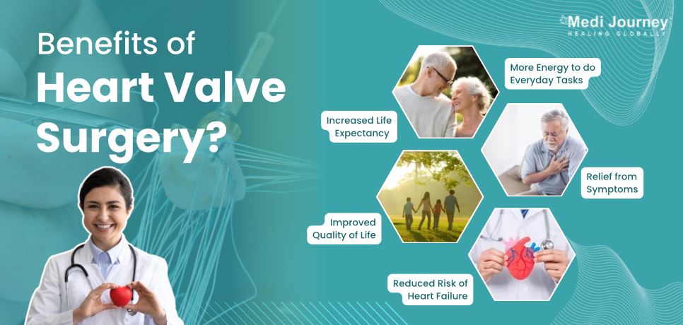 Benefits of Heart Valve Surgery