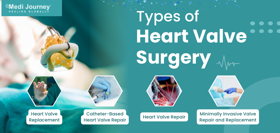 Types of Heart Valve Surgery
