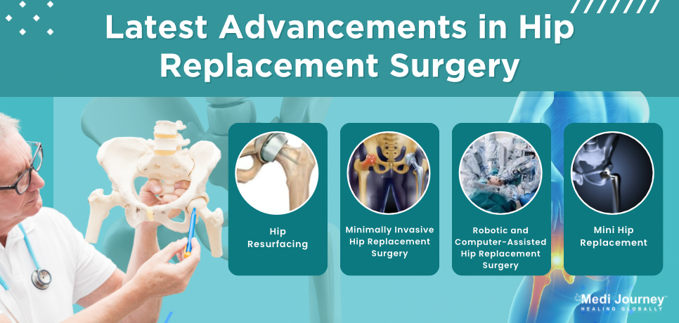Hip Replacement Surgery Advancements