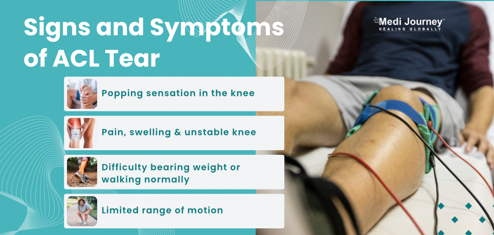 ACL Tear Symptoms