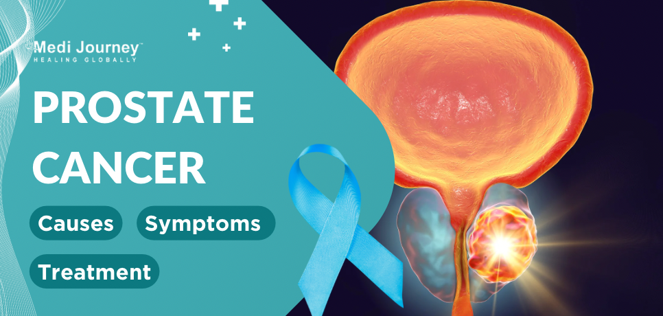 Prostate Cancer: Understanding Causes, Symptoms, and Treatment