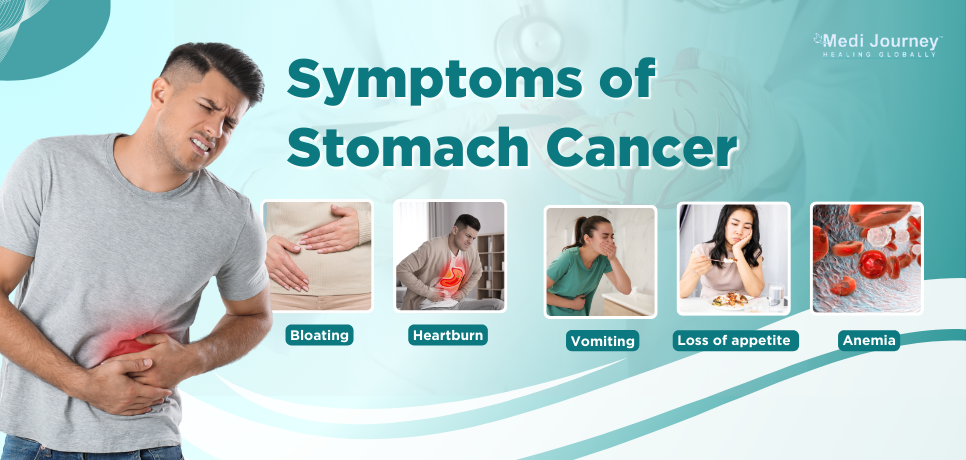 Stomach Cancer Symptoms