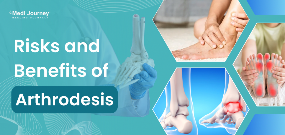 Risks and Benefits of Arthrodesis