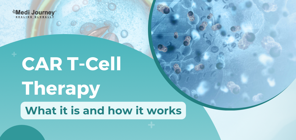 CAR T-Cell Therapy: What it is and how it works