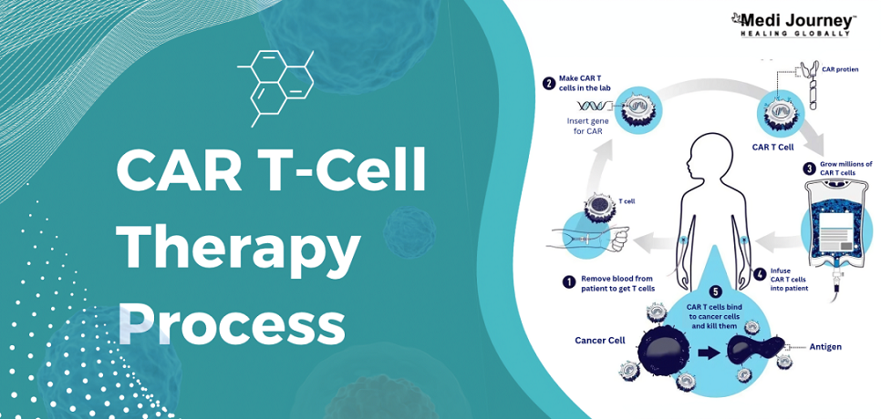 CAR T-cell Therapy Process