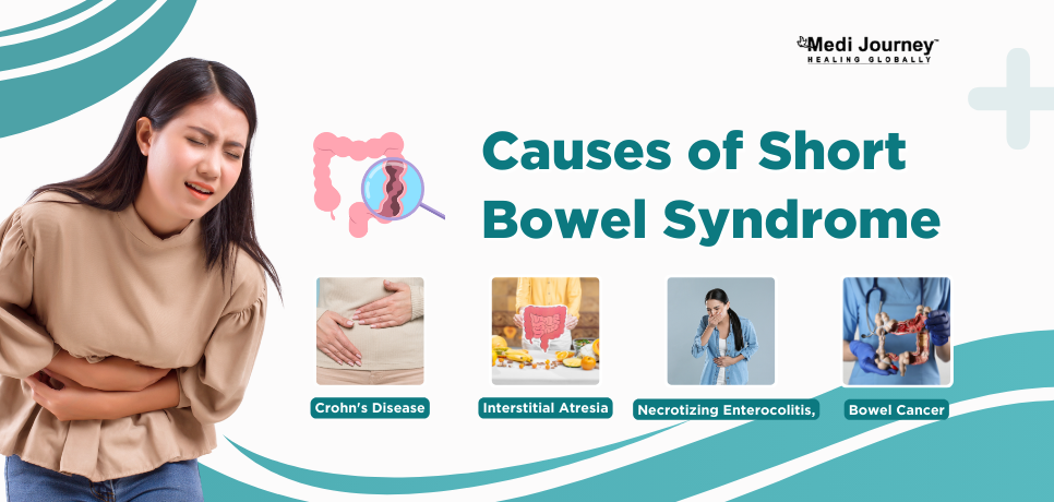 Short Bowel Syndrome Causes