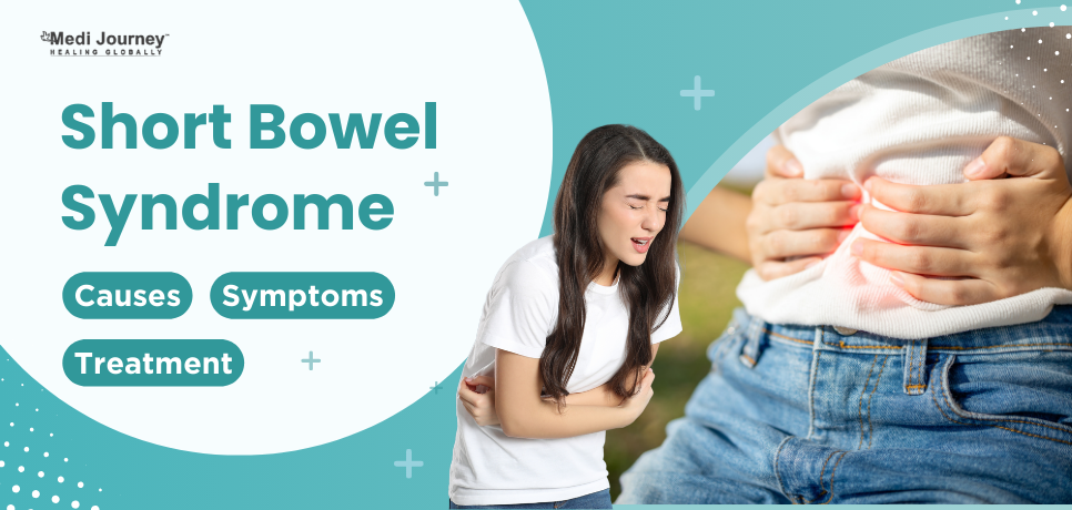 Short Bowel Syndrome: Causes, Symptoms, and Treatment