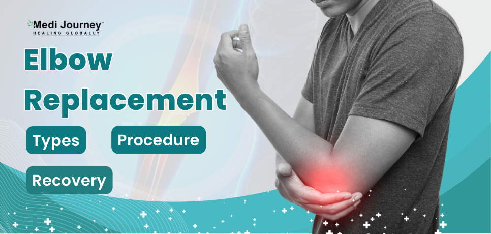 Elbow Replacement: Types, Procedure, and Recovery