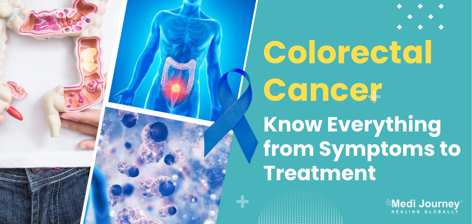 Colorectal Cancer: Know Everything from Symptoms to Treatment