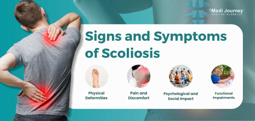 signs and symptoms of scoliosis