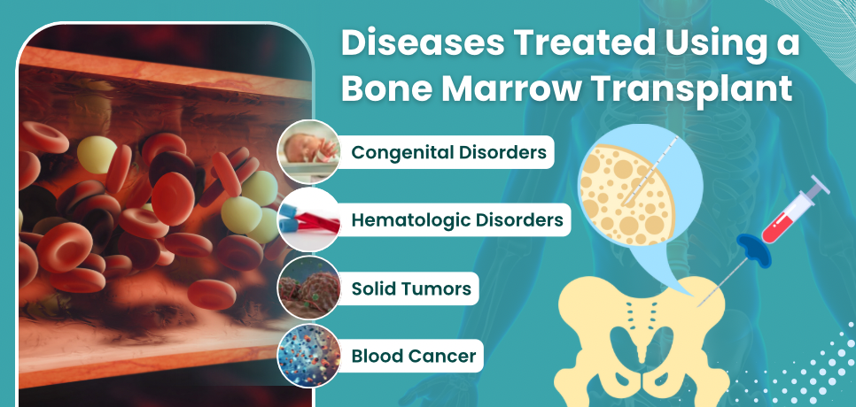 Diseases Treated Using BMT