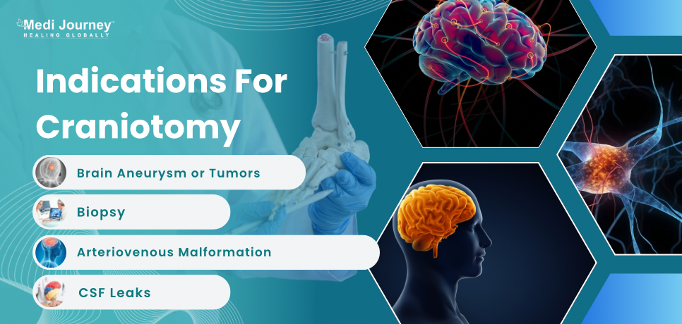 Indications for Craniotomy