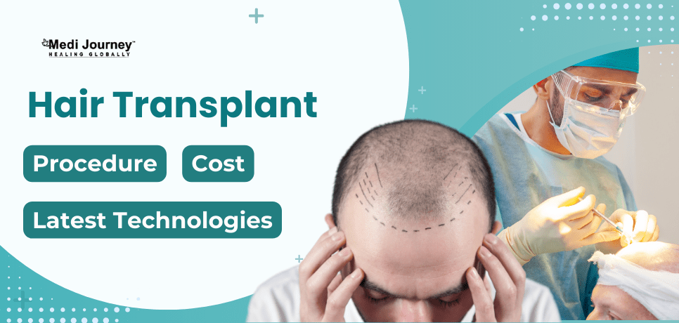 Hair Transplants: Procedure, Latest Technologies, and Success Rate