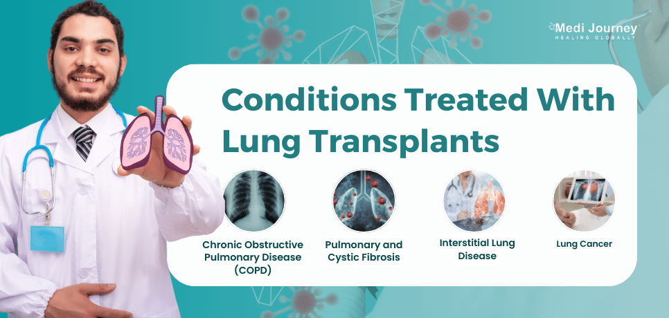 Conditions Treated With Lung Transplant