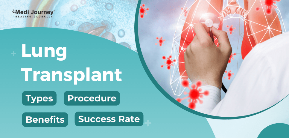 Lung Transplants Explained: Key Benefits and Risks You Should Understand