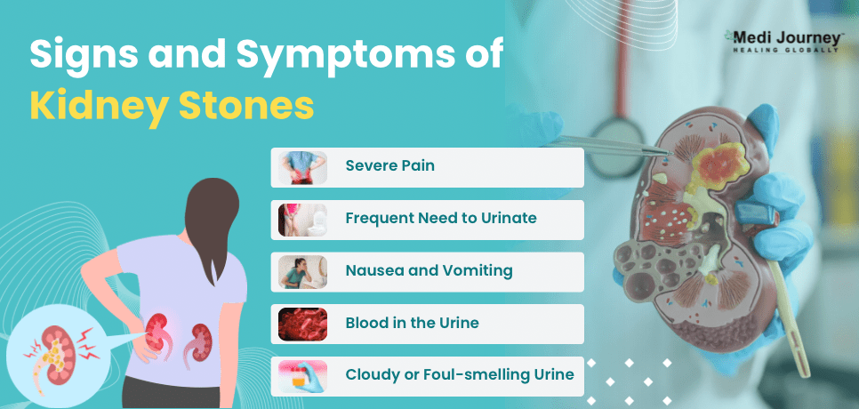 Symptoms of Kidney Stones