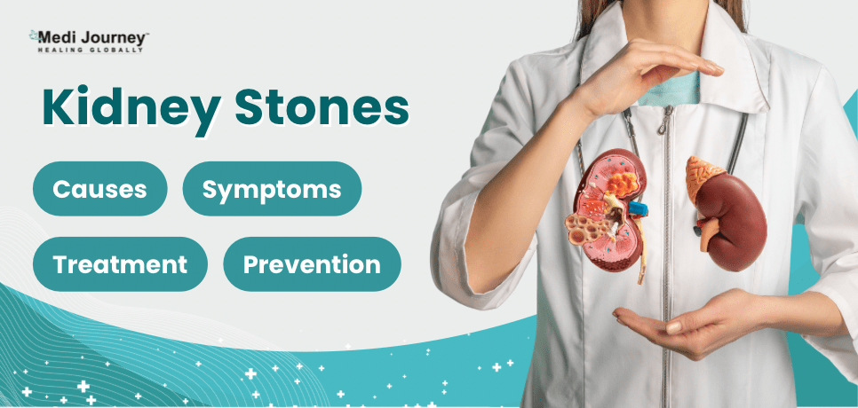 Kidney Stones: Causes, Symptoms, Treatment, and Prevention