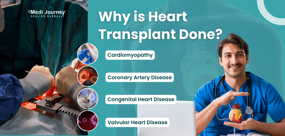 Heart Transplant Requirements