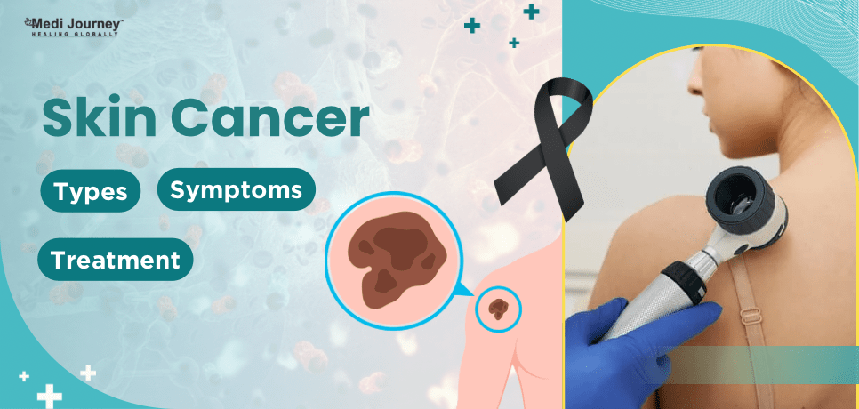 Understanding Skin Cancer: Types, Symptoms, and Treatment