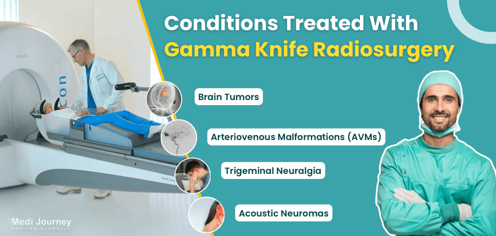 Conditions Treated With Gamma Knife