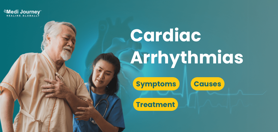 Cardiac Arrhythmias (Irregular Heart Rhythms): Symptoms, Causes, and Treatment